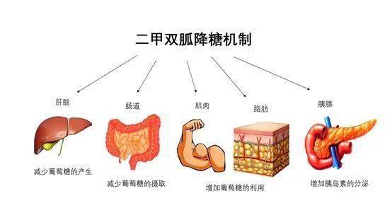 胰岛素抵抗与多囊卵巢图片