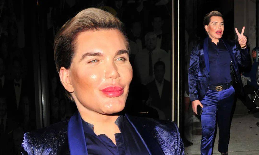 世界上第一个男芭比!整容160次,胸比我的头还大.