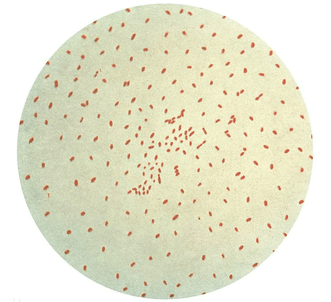 pertussisbordetella百日咳与百日咳鲍特菌认识百日咳01百日咳病染传