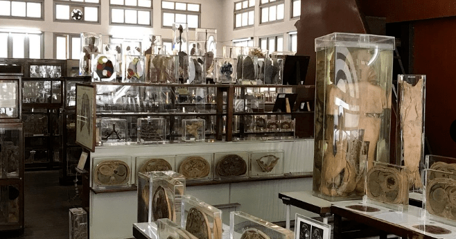 堪称全球最恐怖泰国死亡博物馆展出真人遗体标本