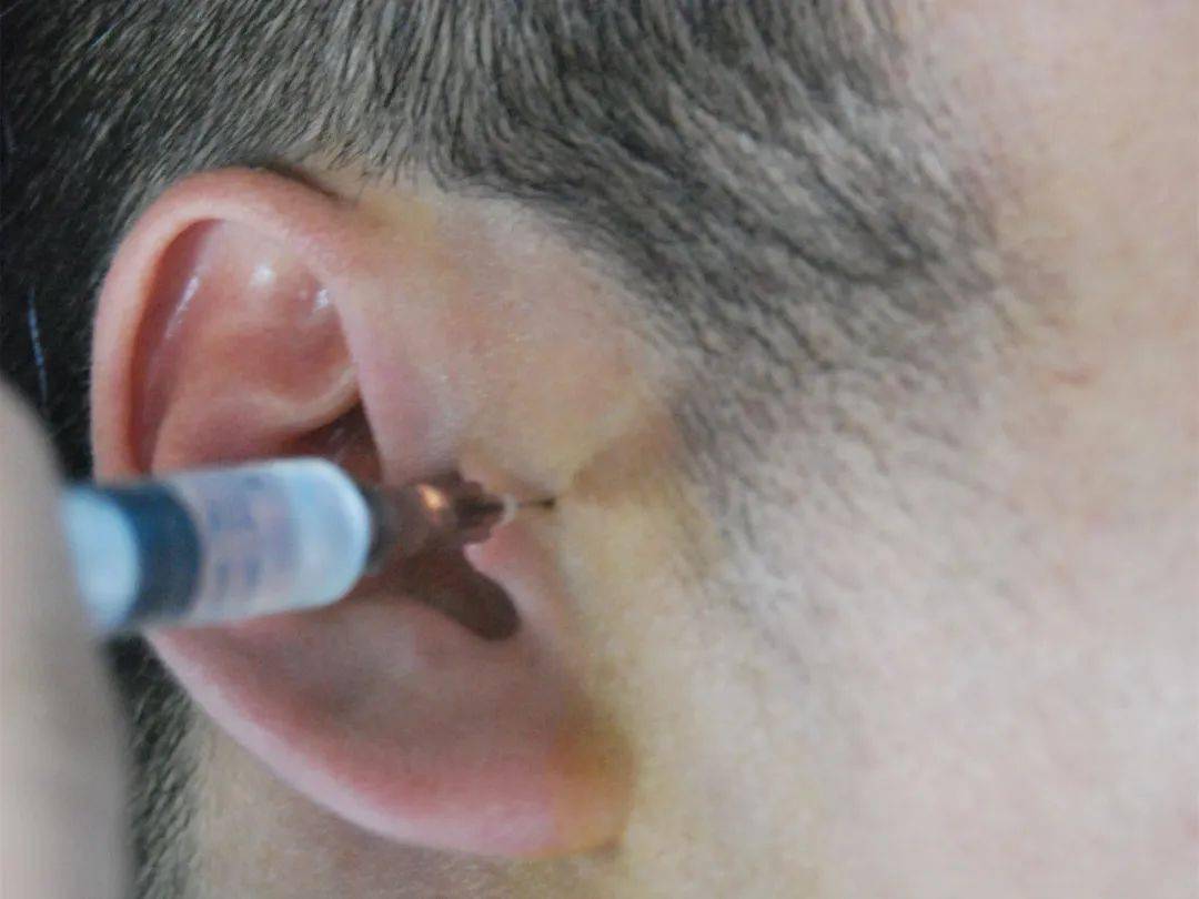 突聋耳后注射位置图图片