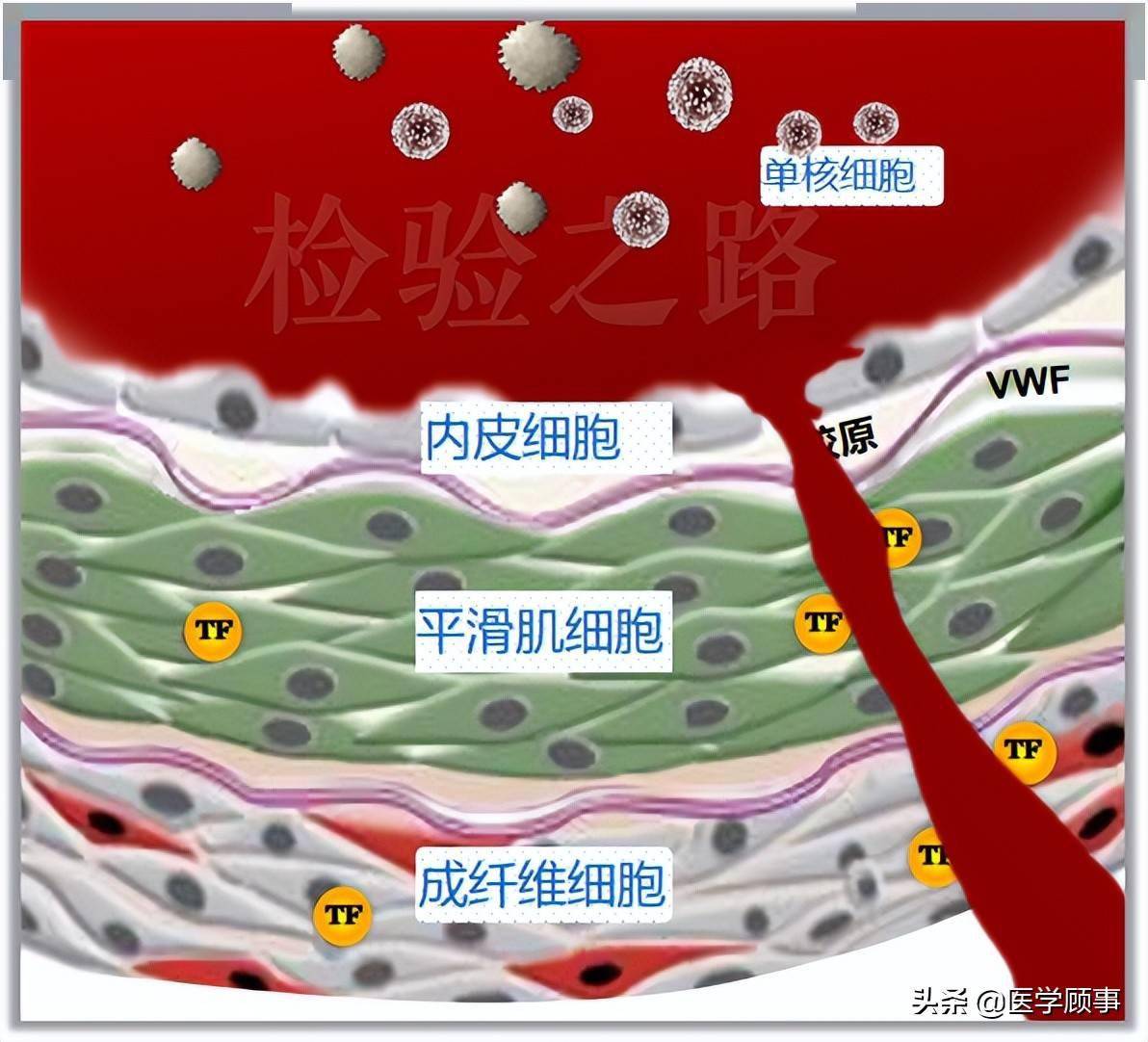 tf在血管外的表达——成纤维细胞,平滑肌细胞血管壁分三层,由外到内