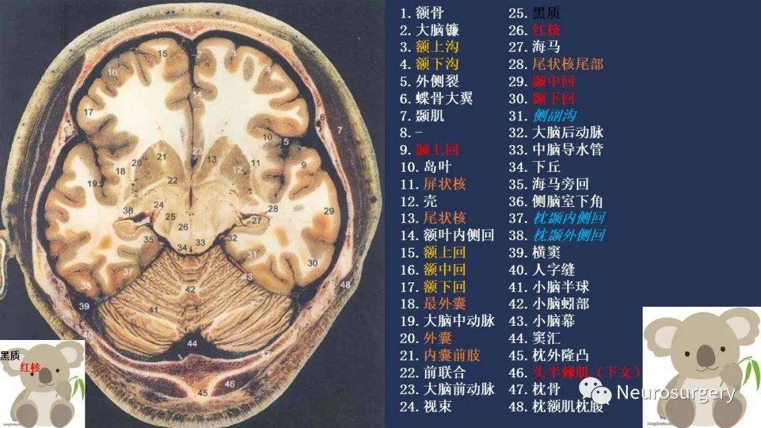 顱腦斷層解剖圖譜