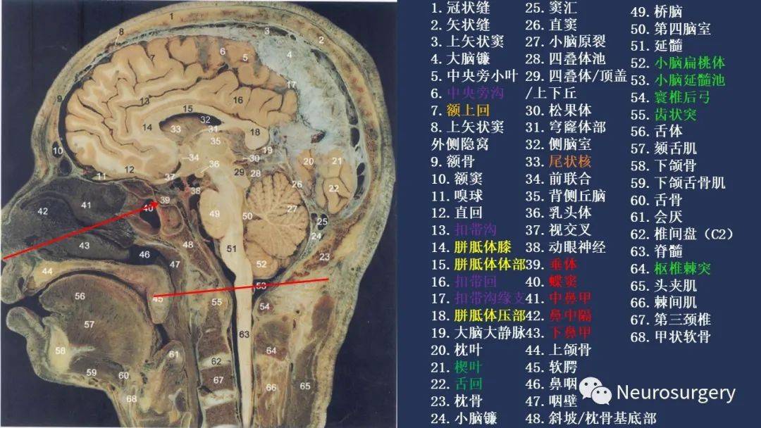 顱腦斷層解剖圖譜