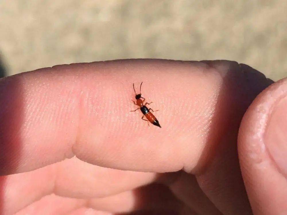 看到这种虫千万别拍打,南宁一女子为此造成皮肤大面积溃烂!