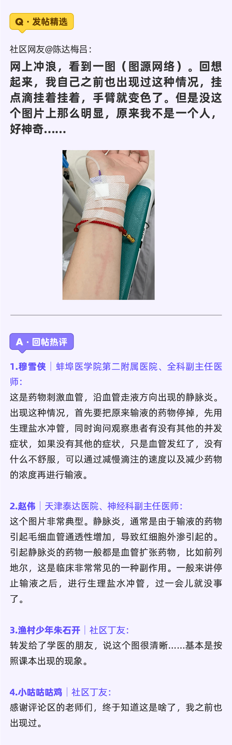 挂点滴 手臂上出现神秘红线 丁香 App 医生