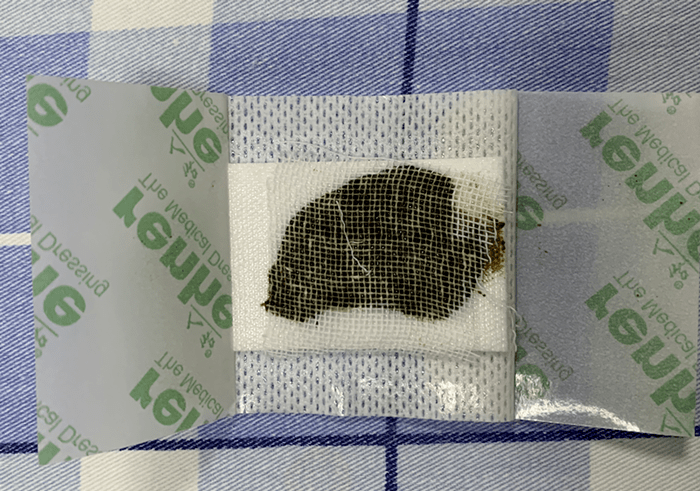 这家医院护士的小发明,让护理工作更出彩!_患者_电极_锻炼