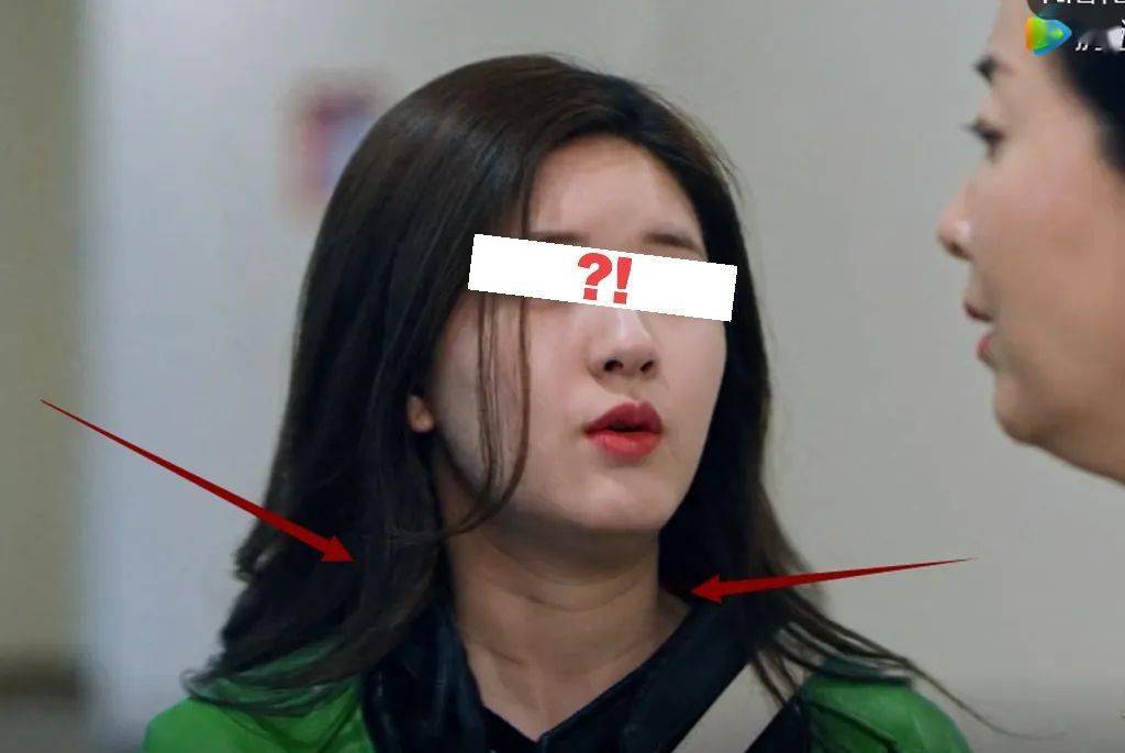 她的国民少女感被谁毁了?_赵露思_颈部_脖子