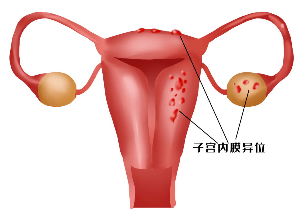 右侧卵巢疼图片