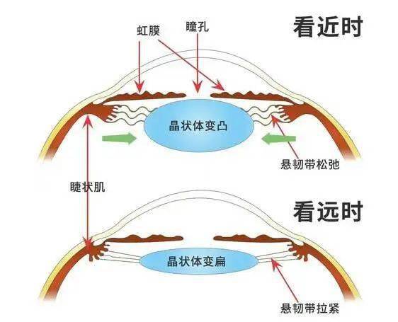 晶體是懸空掛在睫狀突上的,其通過懸韌帶起到連接作用,周邊的類似光芒