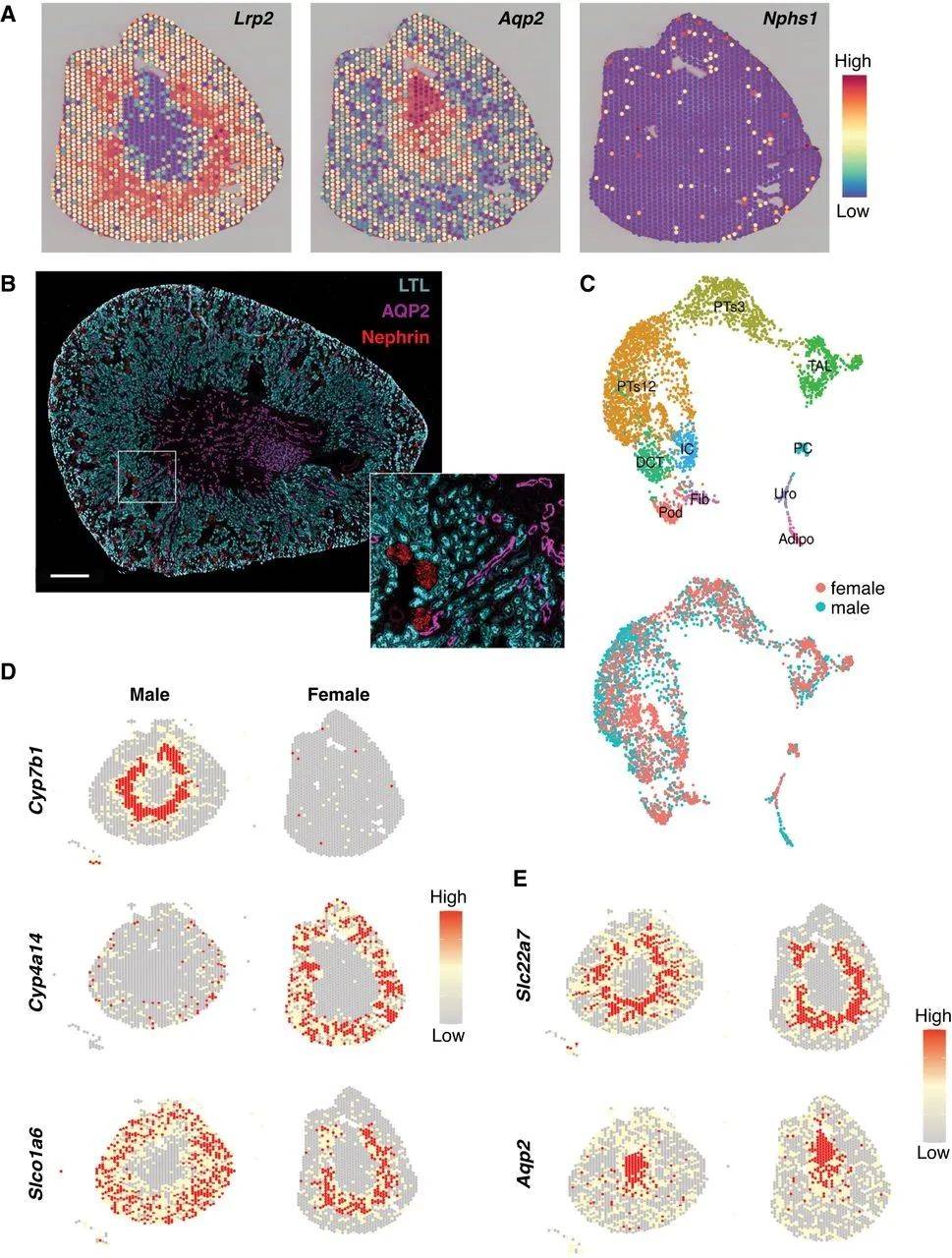 jasn-kidney