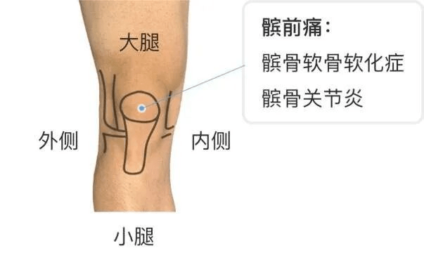 膝关节疼痛自诊部位图图片