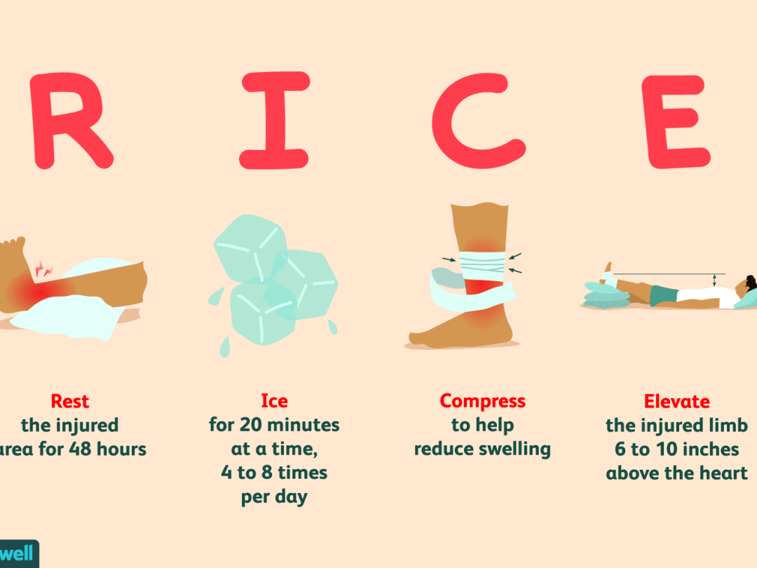 出现急性损伤后应遵循的rice原则首先,健身房需要从用户选择办卡时