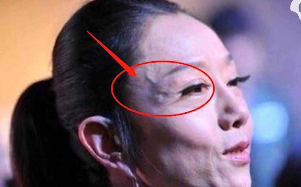 当她摘下帽子那一瞬间,小雨整个人有些愣了,太阳穴处的青筋有异常明显