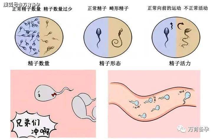 精子活力图图片