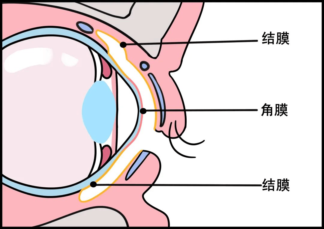 结膜囊是哪个位置图图片