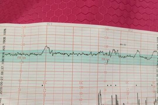 怀孕六个月胎心位置图图片