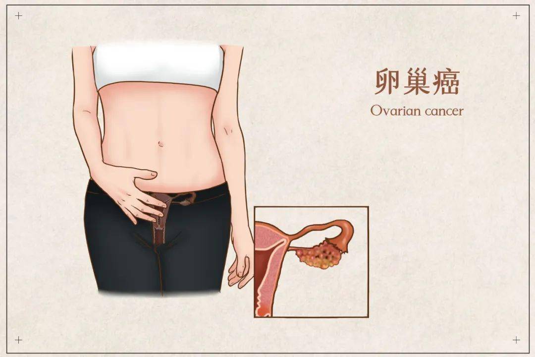 女性阴囊皮脂腺颗粒图片