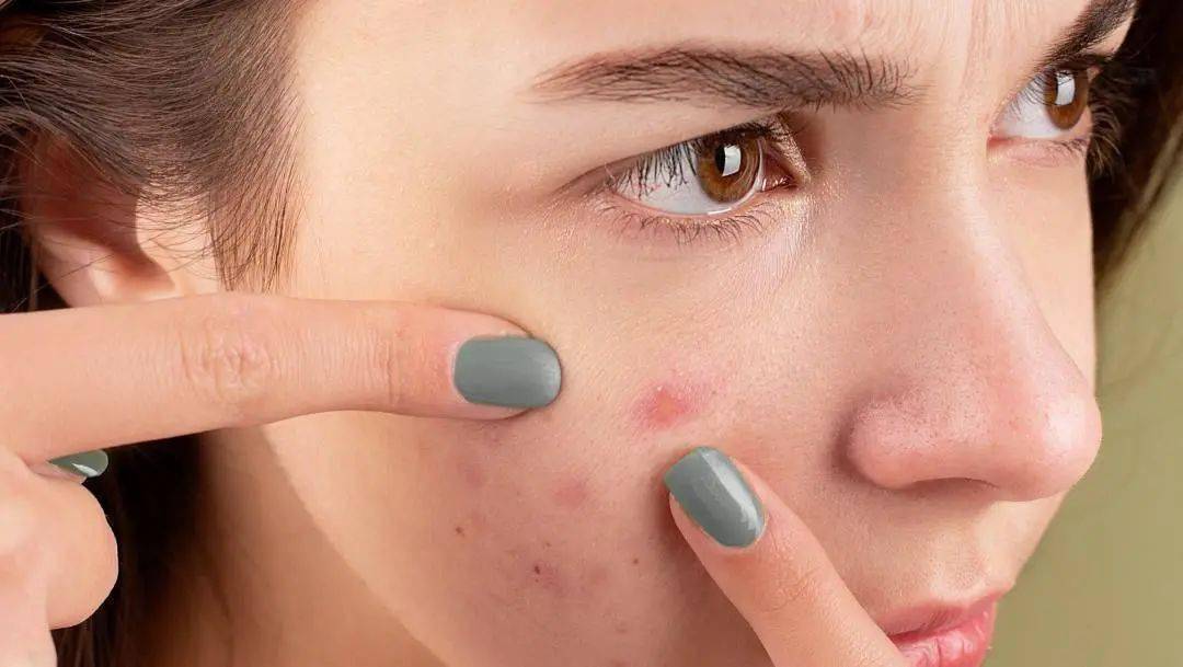 直播间 | 小姐姐们关心的常见医美攻略,来啦~_皮肤_曹蕾_治疗