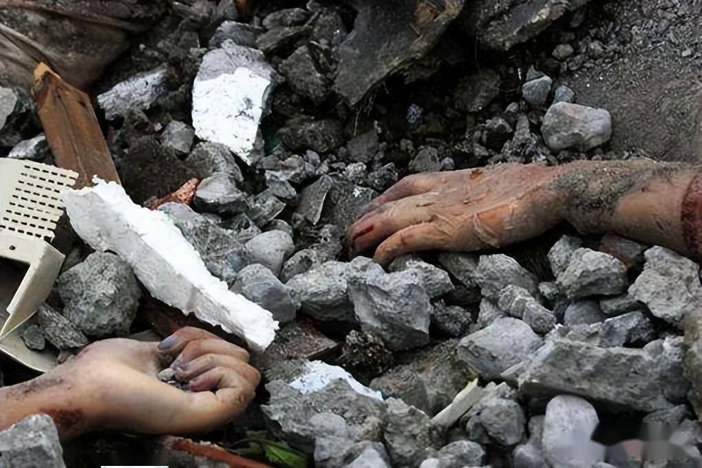 挤压综合征,地震灾害第二大死因的防治_伤员_治疗_肢体