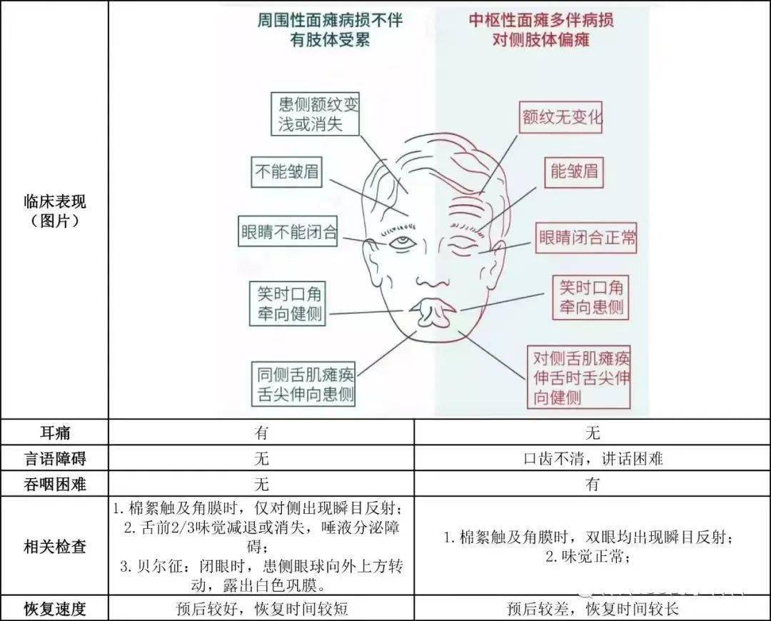 中枢性面神经麻痹及周围性面神经麻痹的差异总结不同部位损伤面神经后