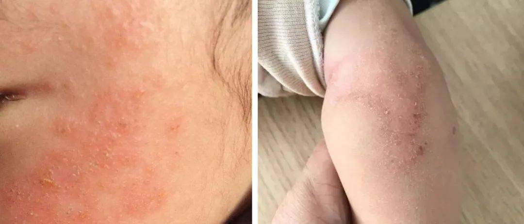 唇膏_白池_树洞