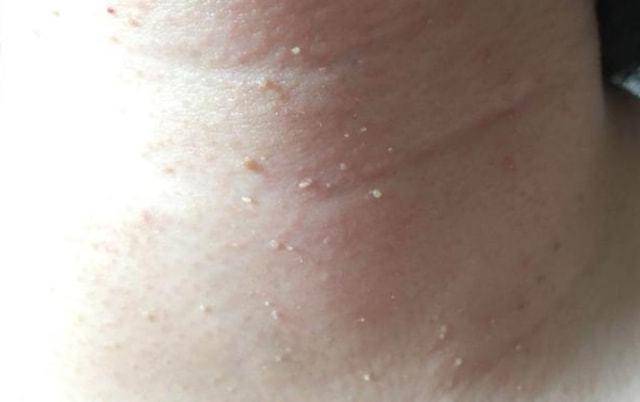 能直接用手揪掉吗?告诉你答案_皮肤_功能_器官