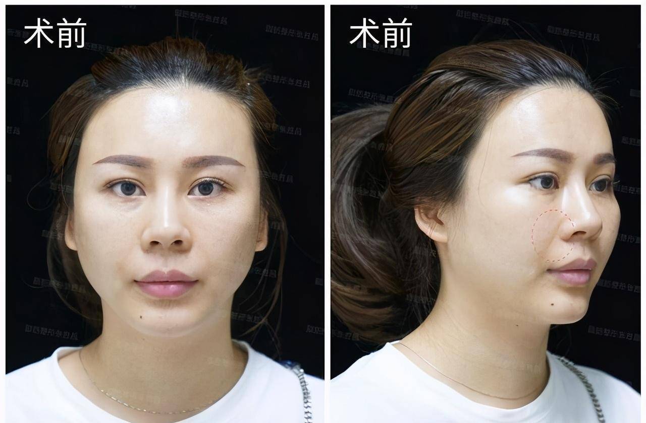 法令纹深|我年轻貌美,颜值高又怎样,法令纹明显,再漂亮也显老_印堂