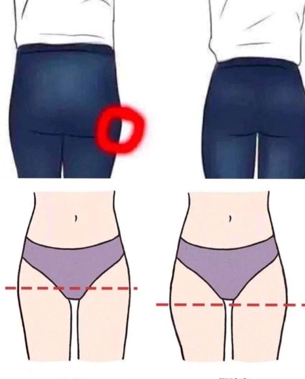 卢九宁谈臀部美学设计:自体脂肪丰臀有啥不一样?_女性_曲线_挺翘