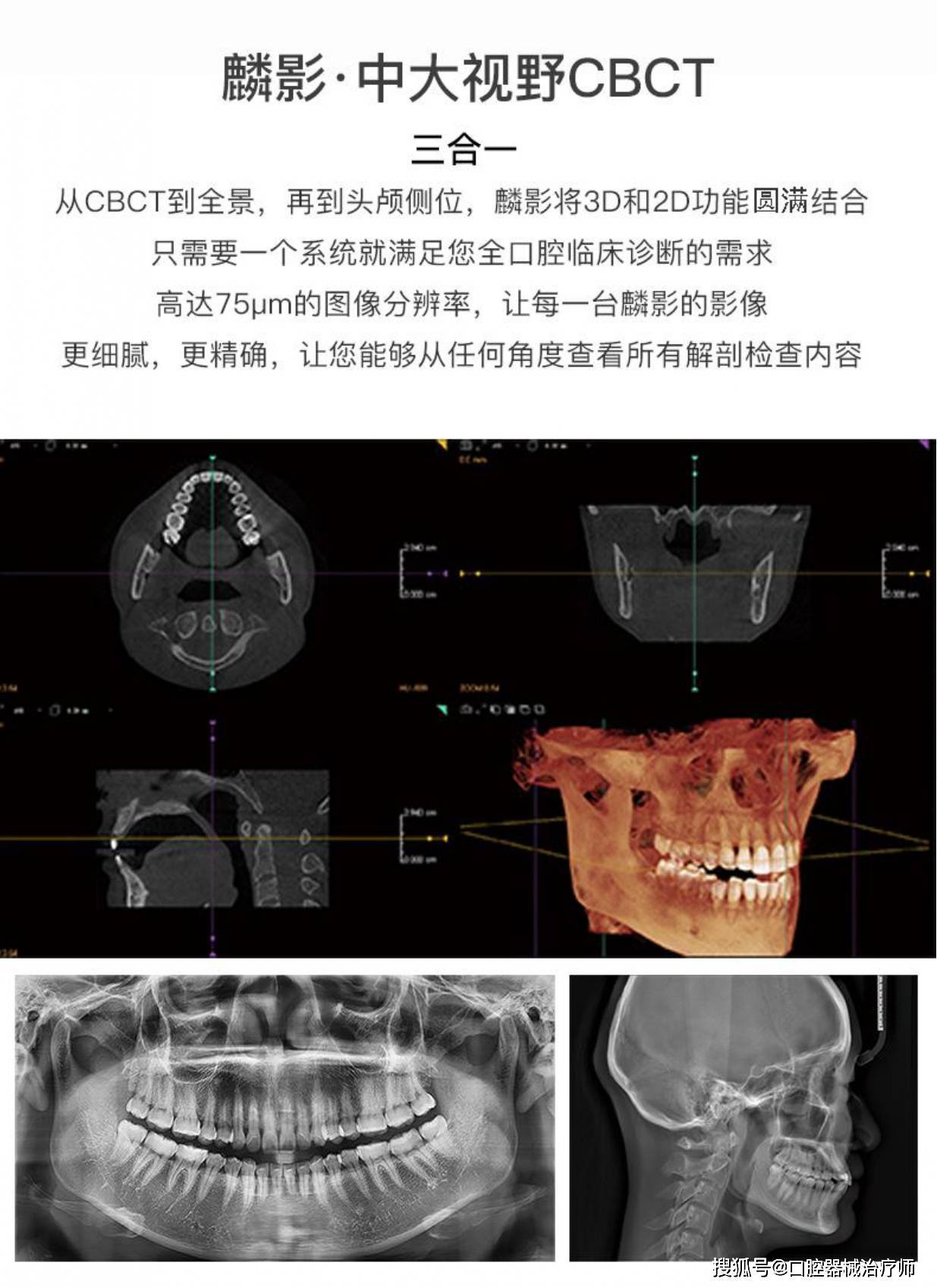 深圳菲森cbct,中大视野,高质量成像_解剖_临床_种植