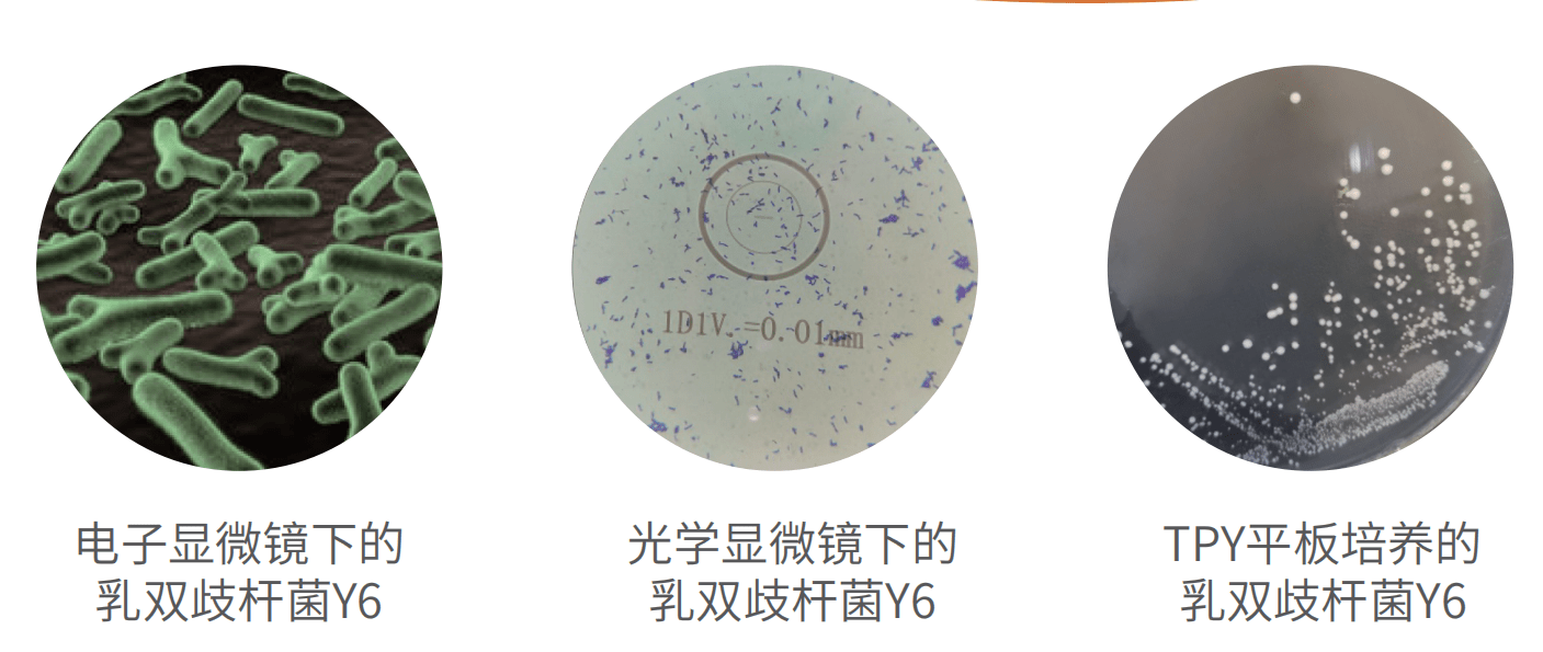 双歧杆菌显微镜图片