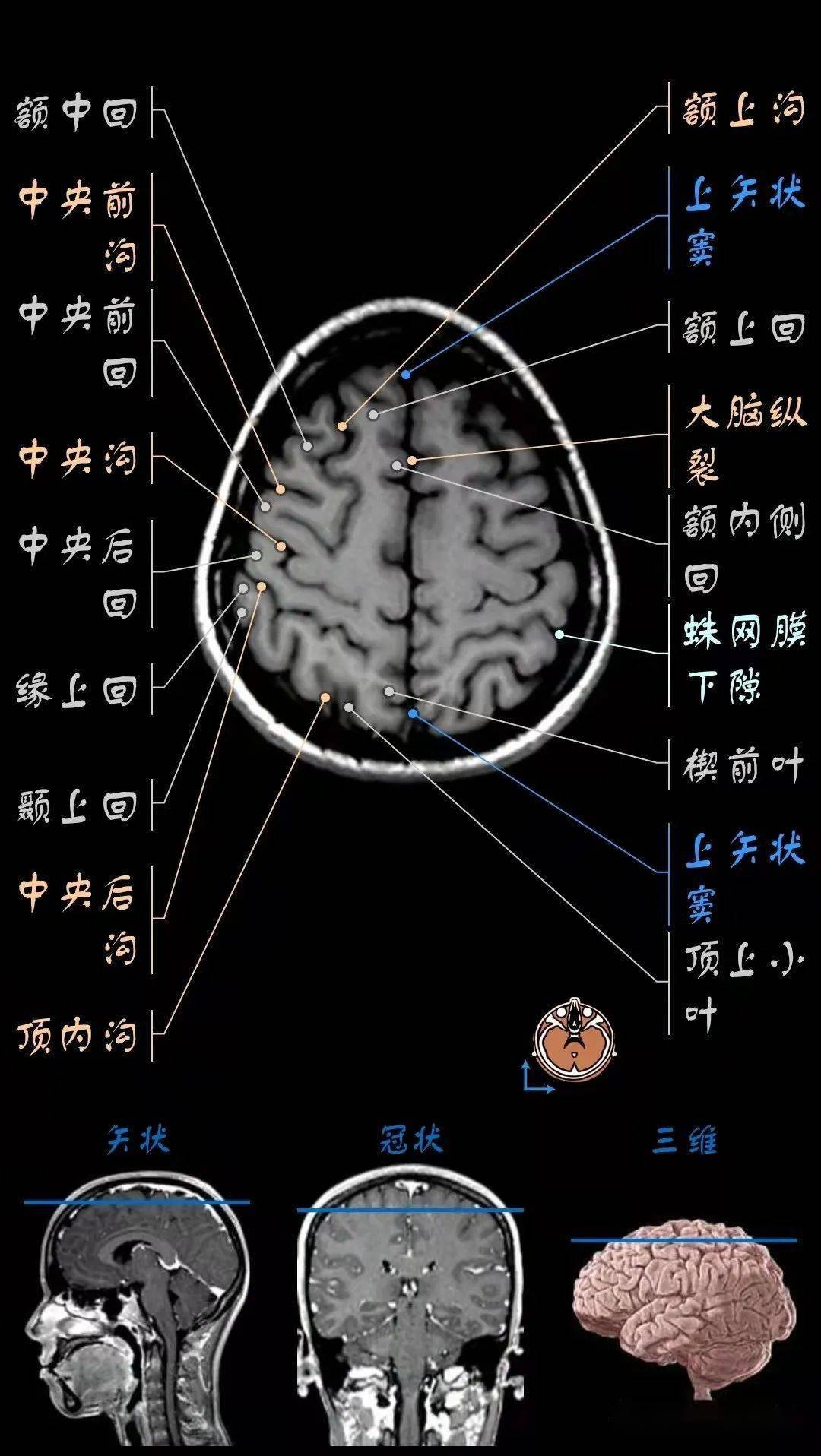 核磁头颅解剖图图片