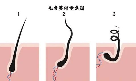 头发细软,稀少,易脱?根本原因竟是它._毛囊_毛发_头皮