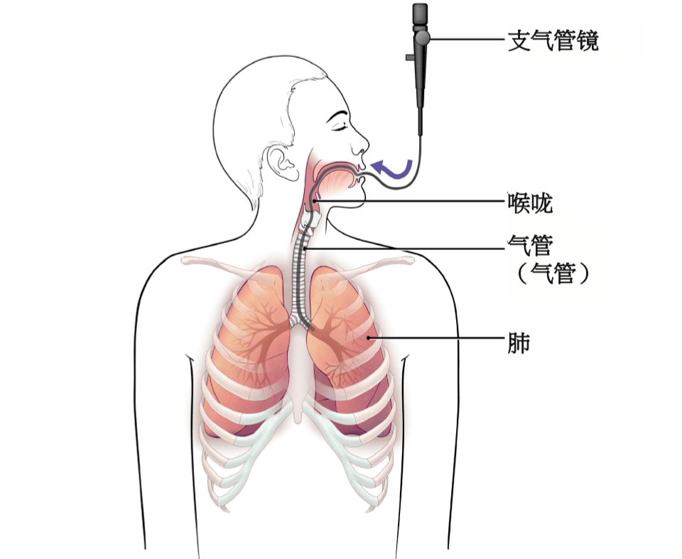 人的全身气管位置图图片