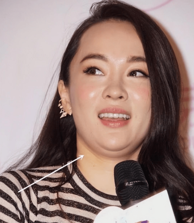 胸下垂,妊辰纹突出,身材走样,这四位女星怀孕才算人间真实!