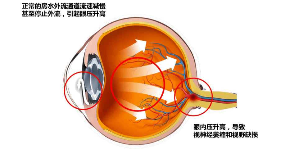 眼睛房水位置图片图片