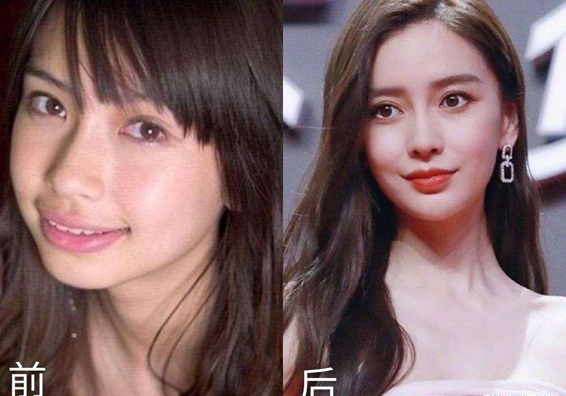 吴宣仪生图惹争议:脸肿下巴尖,整牙后她为什么变丑了?_牙齿_网友_脸部