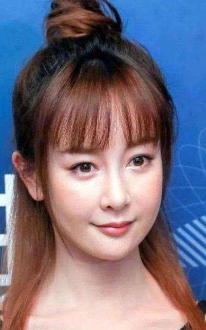 明星们的玻尿酸脸"垮了", 李小璐塑料脸, 蔡明没想到啊!