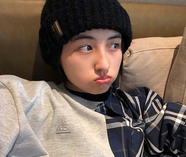 有种"真实"叫张子枫晒素颜照,痘痘雀斑一览无遗,真不怕掉粉啊_形象