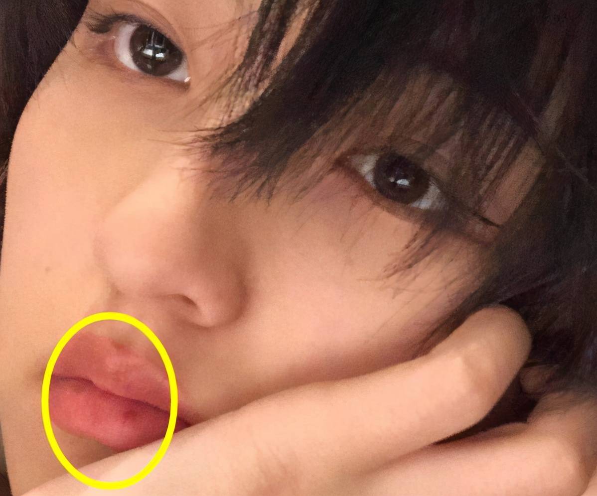 不过嘴角痕迹才是全景亮点,张子枫嘴巴上有一处"伤痕",像极了"咬痕"