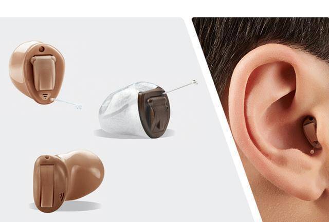 富顺惠耳(宏帆广场店)助听器科普——助听器的种类有哪些?
