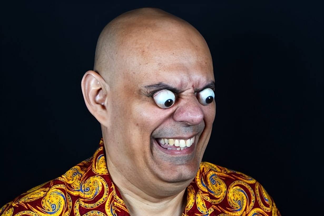 巴西男子创造新的世界纪录,他的眼睛能凸出近2厘米