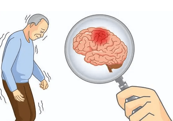 秋冬季节谨防脑中风,这几类人群要注意!_障碍_疾病_气血