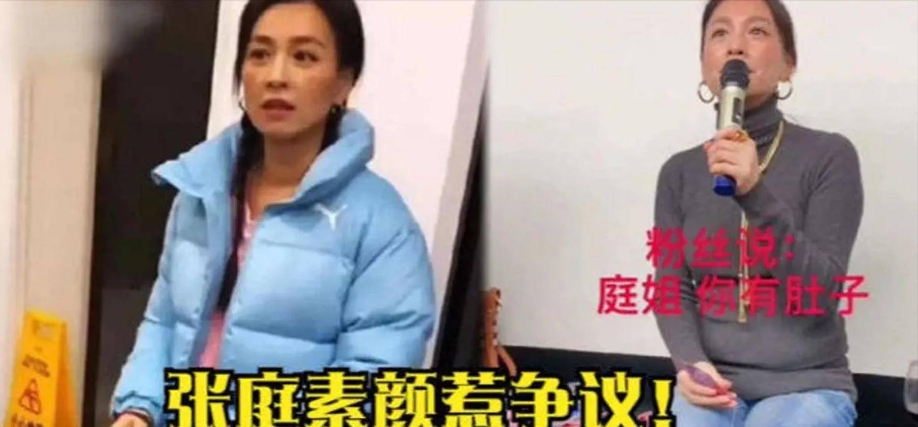 张庭实在素颜照曝光，肤色蜡黄像村妇，网友吐槽：还没素人标致