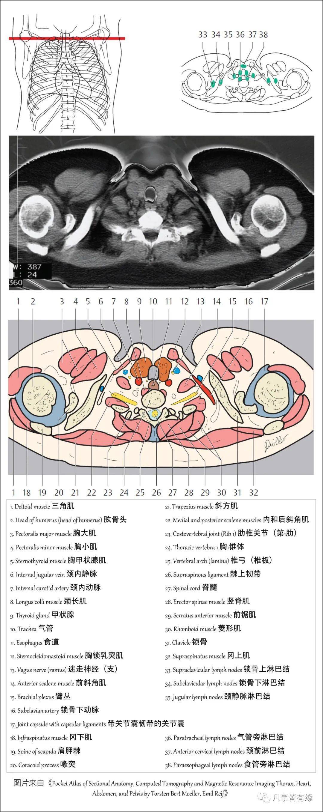 【保藏】胸部的断层剖解