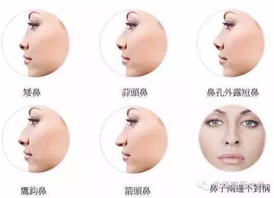 隆鼻vs鼻综合丨差别是什么 鼻梁 整形 高度