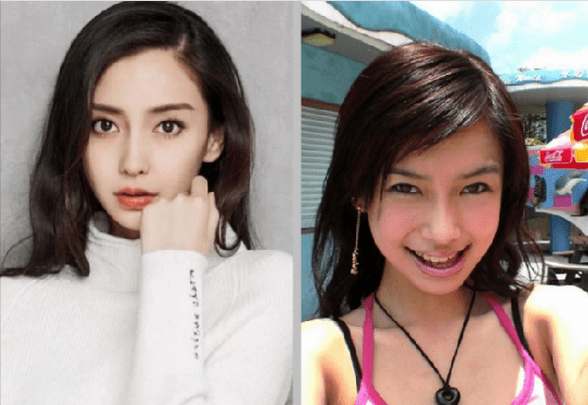 傅园慧整牙后"洪荒少女"变"仙女",网友:错怪baby了?_因为_游泳_牙齿