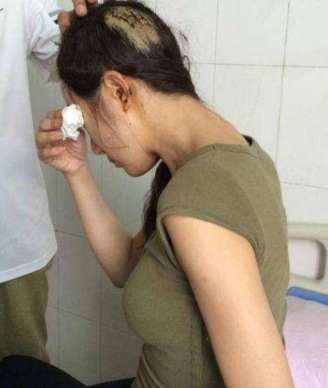 2014年,李依晓参加印小天生日会,当场被宠物狗咬到"毁容"_叶璇_言论