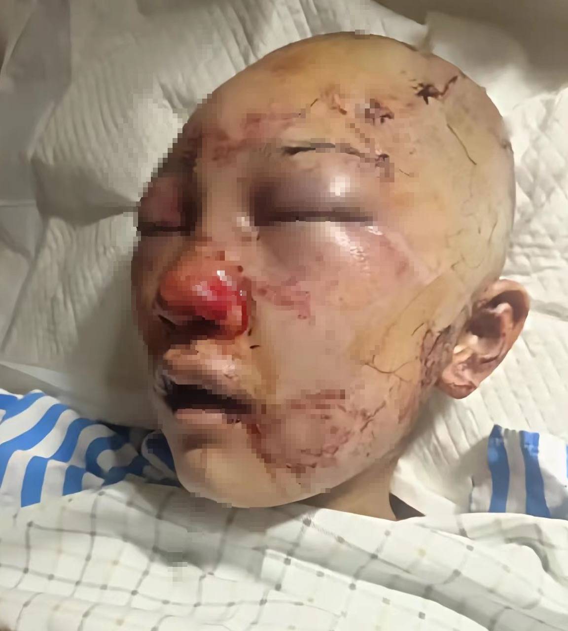 律师评男子公厕殴打美女:若重伤以上刑期3到10年,赔偿影响量刑_鉴定