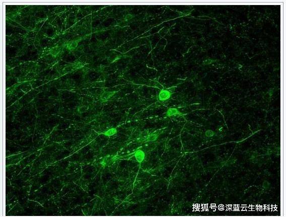 免疫荧光显微成像详解（上）——免疫荧光原理、步骤_进行_抗体_抗原